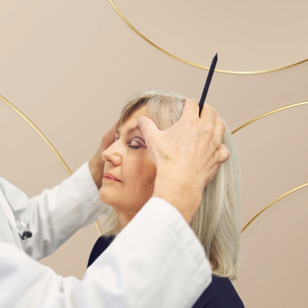 Rejuvenecimiento facial