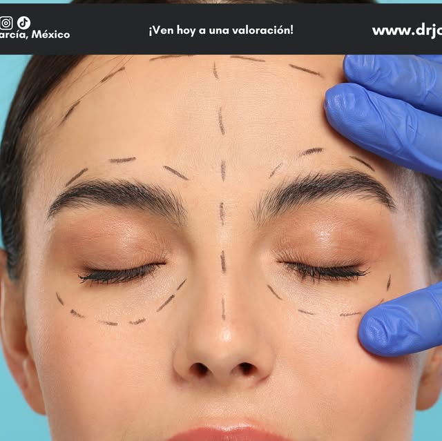 Rejuvenecimiento facial