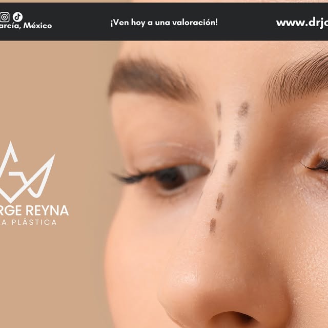 Rinoplastia estética